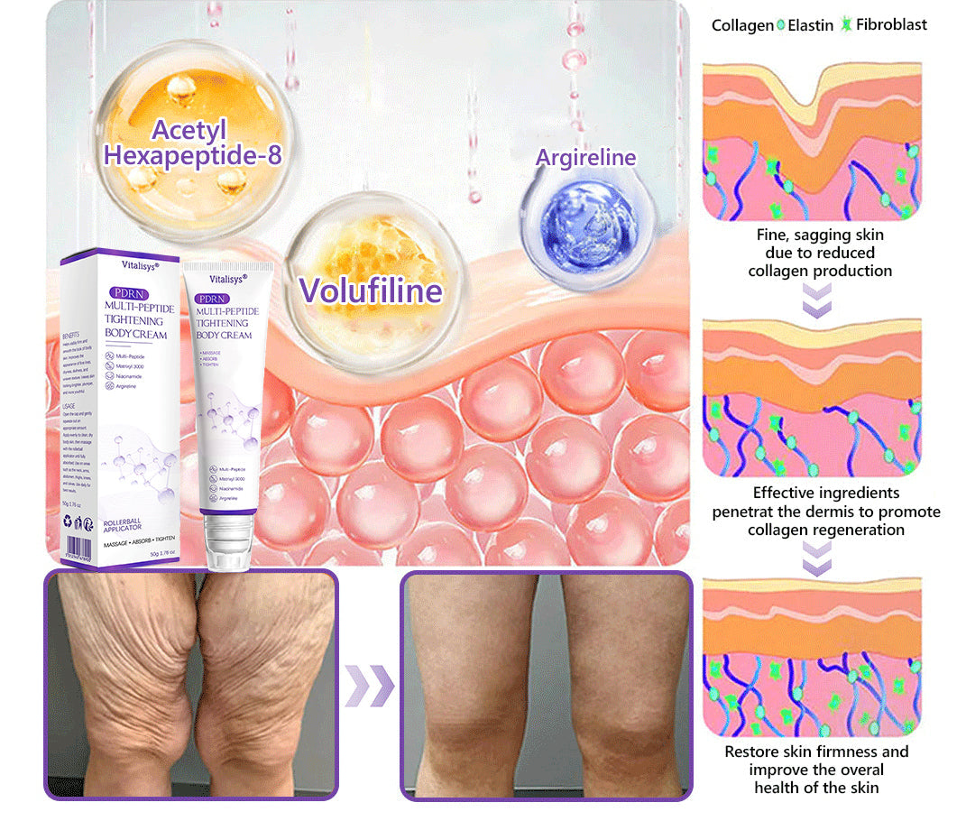 Vitalisys®🎉 PDRN Multi-Peptide Massaging Body Roller Cream- Anti-aging, Hydrating, Skin Firming & Lifting, Skin Repair, Even Tone, Acne and Dark Spot Treatment, Wart and Mole Removal, and Psoriasis Relief.