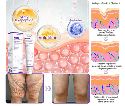 Vitalisys®🎉 PDRN Multi-Peptide Massaging Body Roller Cream- Anti-aging, Hydrating, Skin Firming & Lifting, Skin Repair, Even Tone, Acne and Dark Spot Treatment, Wart and Mole Removal, and Psoriasis Relief.