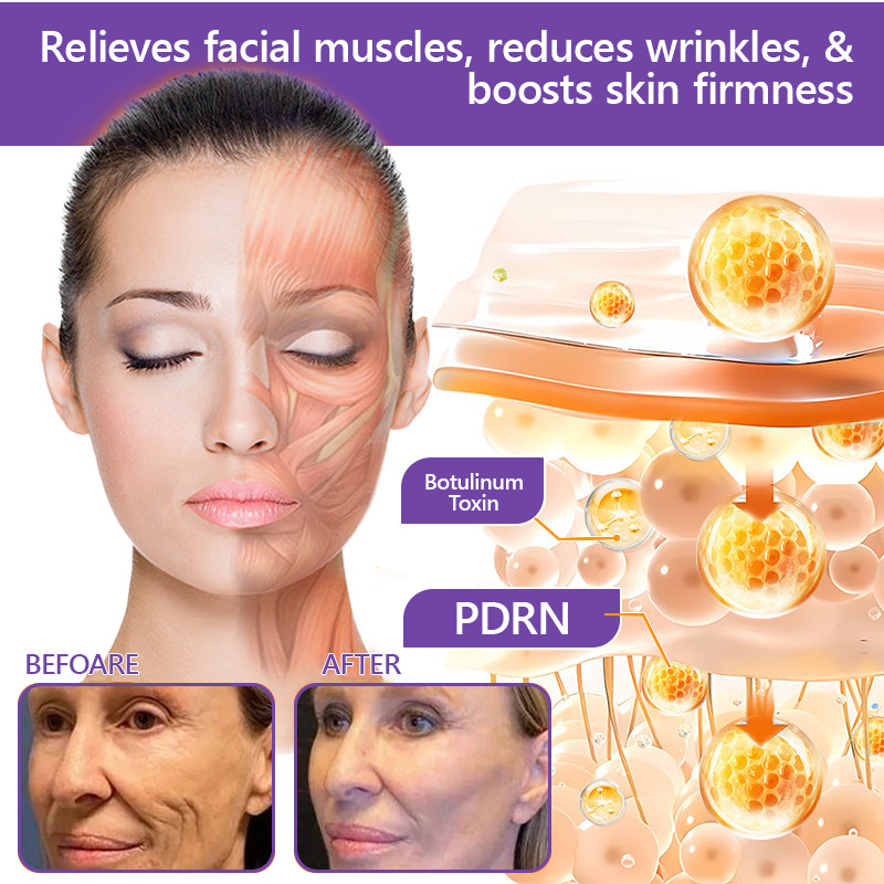 Vitalisys®🎉 PDRN Multi-Peptide Massaging Body Roller Cream- Anti-aging, Hydrating, Skin Firming & Lifting, Skin Repair, Even Tone, Acne and Dark Spot Treatment, Wart and Mole Removal, and Psoriasis Relief.