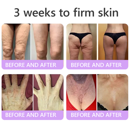 Vitalisys®🎉 PDRN Multi-Peptide Massaging Body Roller Cream- Anti-aging, Hydrating, Skin Firming & Lifting, Skin Repair, Even Tone, Acne and Dark Spot Treatment, Wart and Mole Removal, and Psoriasis Relief.