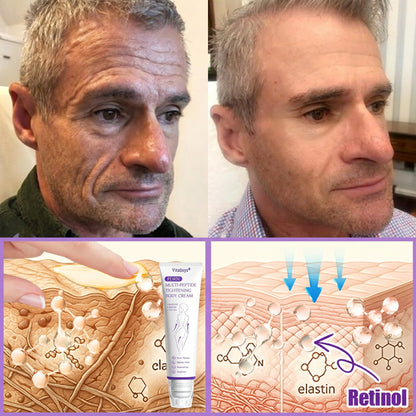 Vitalisys®🎉 PDRN Multi-Peptide Massaging Body Roller Cream- Anti-aging, Hydrating, Skin Firming & Lifting, Skin Repair, Even Tone, Acne and Dark Spot Treatment, Wart and Mole Removal, and Psoriasis Relief.